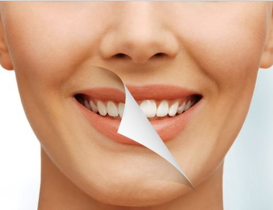 Restaurações Estéticas